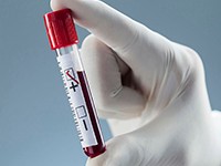 Book lab tests